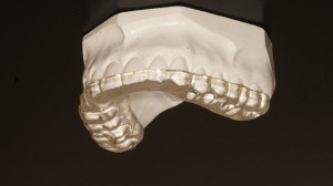 Bruxism