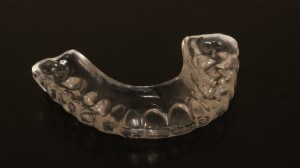 TMJ treatment north canton