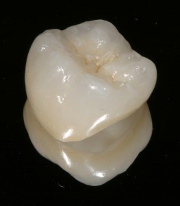 Dental Crown