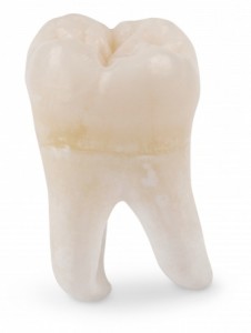 extractions