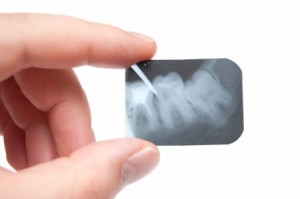 Periodontal Screening Exam