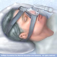 Sleep Apnea Treatment